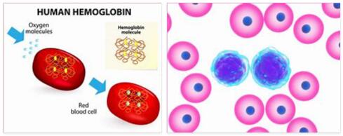 Hemoglobinopathy